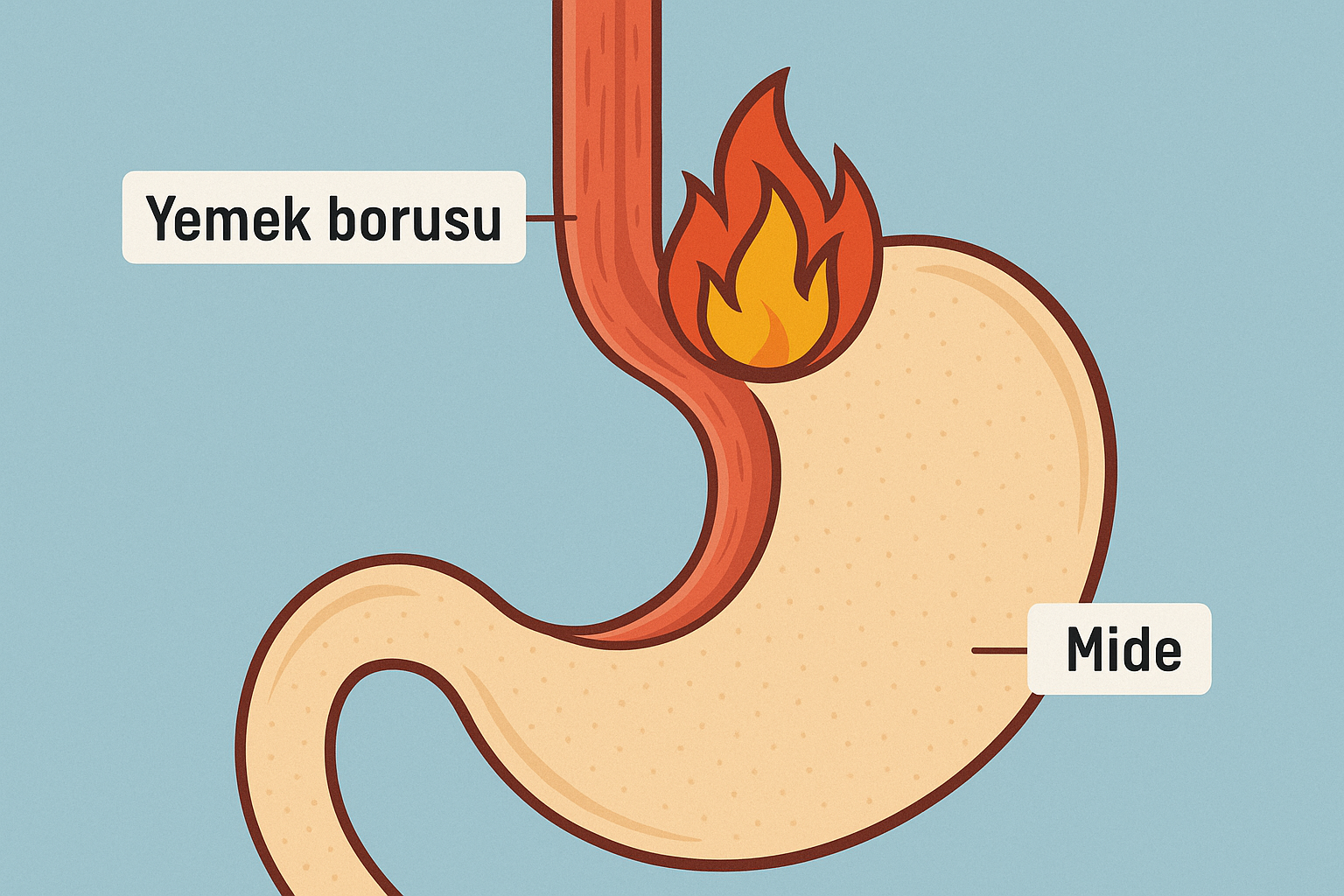 reflü nedir, reflü belirtileri nelerdir, reflü hakkında yanlış bilgiler